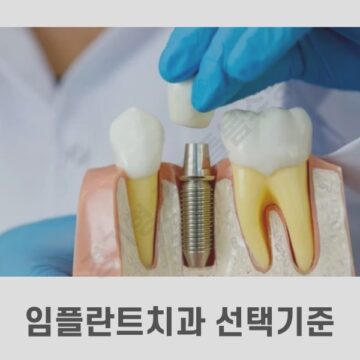 임플란트치과 선택기준